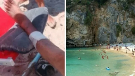 Morsi nel mare del Cilento: due bagnanti feriti tra Palinuro e Pioppi