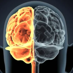 Alzheimer, la corteccia cerebrale può cambiare anni prima delle placche visibili alla PET