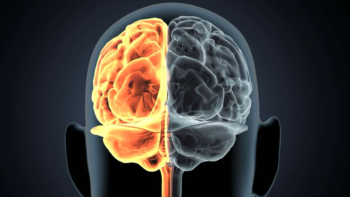 Alzheimer, la corteccia cerebrale può cambiare anni prima delle placche visibili alla PET
